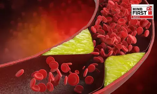 Bad Cholesterol Control Tips: ख़राब कोलेस्ट्रॉल से कैसे पाएं निजात? अपनाएं ये पांच चीज़ें