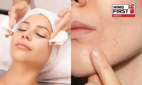 Beauty Tips: पार्लर में हमेशा फेशियल कराने की है आदत तो जान लीजिए इसके साइड इफेक्ट्स