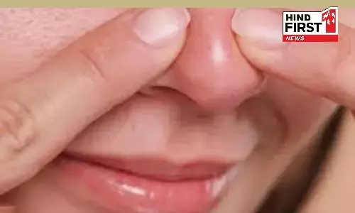 Health Alert: नाक पर होने वाले फोड़े फुंसियों को भोड़ने की गलती बन सकती है मौत का कारण