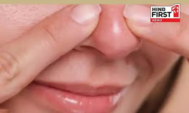 Health Alert: नाक पर होने वाले फोड़े फुंसियों को भोड़ने की गलती बन सकती है मौत का कारण