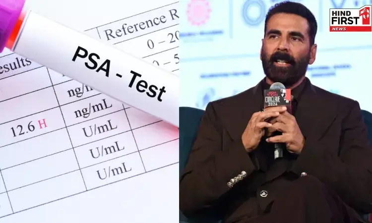 PSA Test for Men: बॉलीवुड स्टार अक्षय कुमार ने 50 पार हर मर्द को दी PSA टेस्ट कराने की सलाह, जानिए क्यों