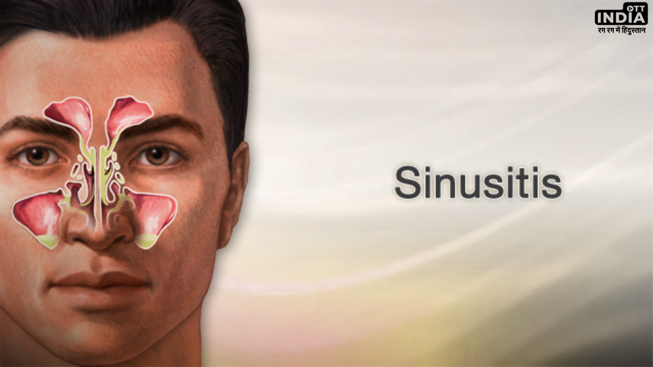 Sinusitis Home Remedies: साइनोसाइटिस क्या है? जानें इसके कारण, लक्षण और घरेलु उपचार Sinusitis Home Remedies: साइनोसाइटिस क्या है? जानें इसके कारण, लक्षण और घरेलु उपचार