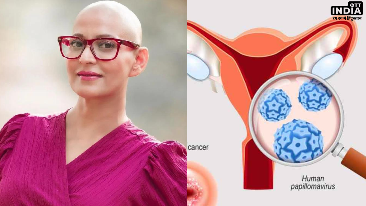 Dolly Sohi Death: सर्वाइकल कैंसर से हुई डॉली सोही की मौत, जानें क्यों खतरनाक है यह बीमारी Dolly Sohi Death: सर्वाइकल कैंसर से हुई डॉली सोही की मौत, जानें क्यों खतरनाक है यह बीमारी