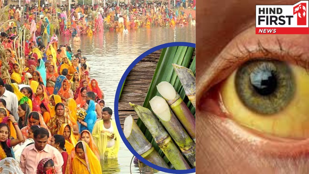Sugarcane Benefits: छठ में चढ़ने वाले गन्ने में छुपा है पीलिया का रामबाण इलाज़