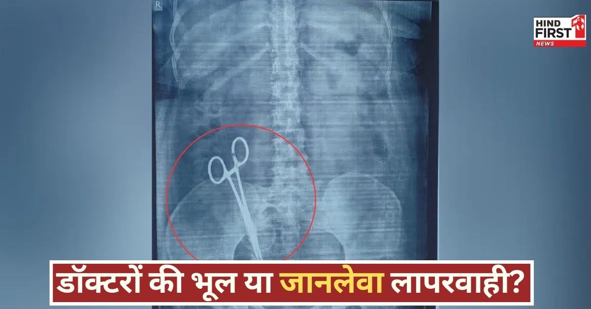 सर्जरी के 17 साल बाद महिला को हुआ तेज दर्द, एक्स-रे में दिखी कैंची, जानिए फिर क्या हुआ? सर्जरी के 17 साल बाद महिला को हुआ तेज दर्द, एक्स-रे में दिखी कैंची, जानिए फिर क्या हुआ?
