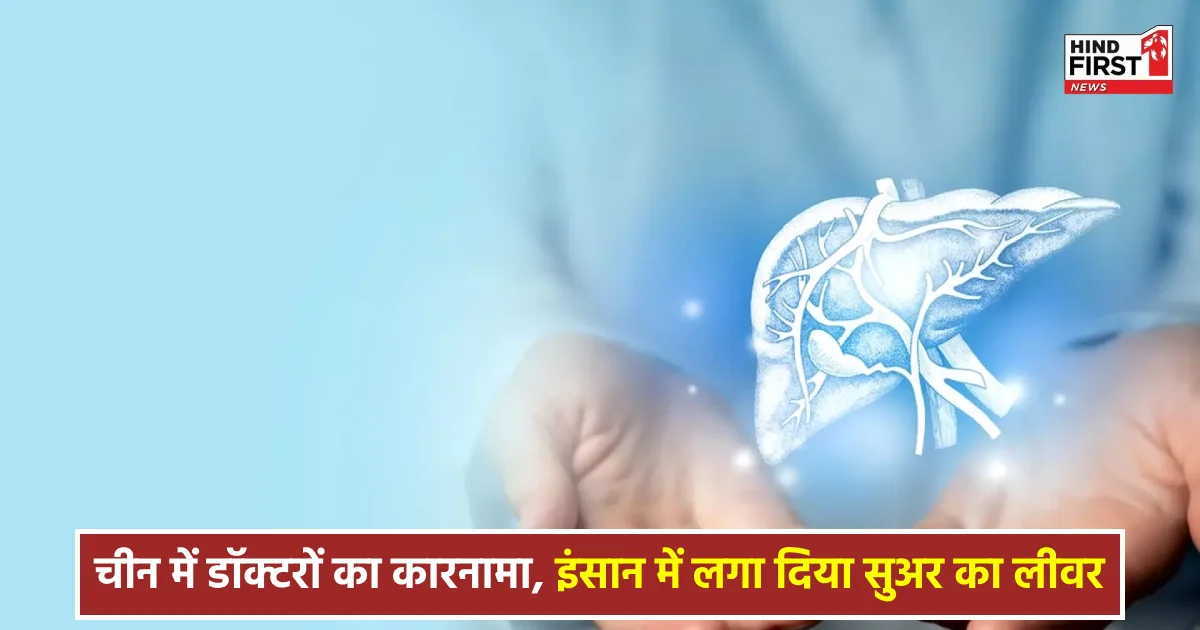 Science News: चीन में डॉक्टरों का कारनामा, इंसान में लगा दिया सुअर का लीवर, बच गई मरीज की जान