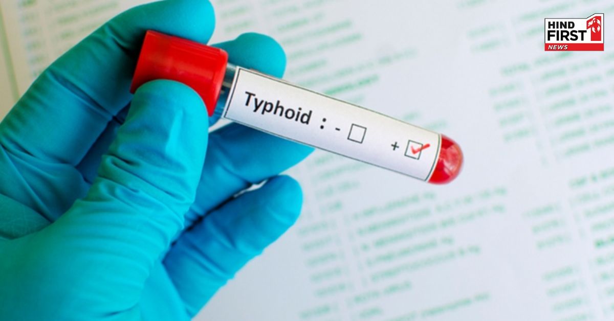 Typhoid Fever Cause: क्यों होता है टाइफाइड? जानिए इसके लक्षण और बचाव के उपाय