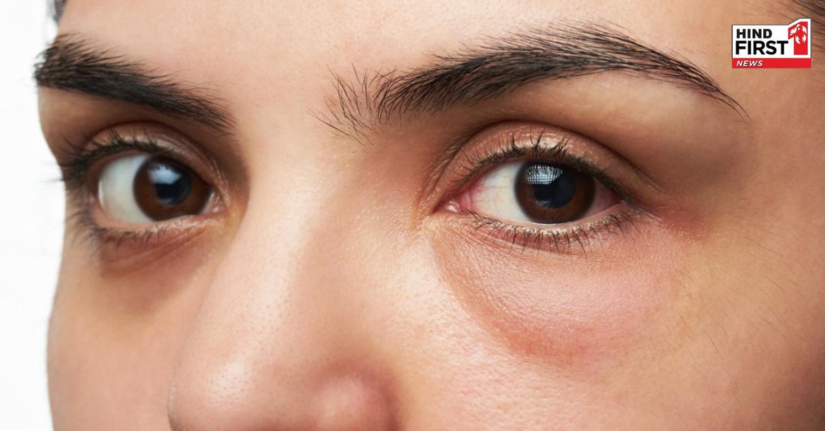 Yoga For Swollen Eyes: सूजी हुई आँखों से चाहते हैं छुटकारा ? ये योगासन साबित होंगे कारगर Yoga For Swollen Eyes: सूजी हुई आँखों से चाहते हैं छुटकारा ? ये योगासन साबित होंगे कारगर