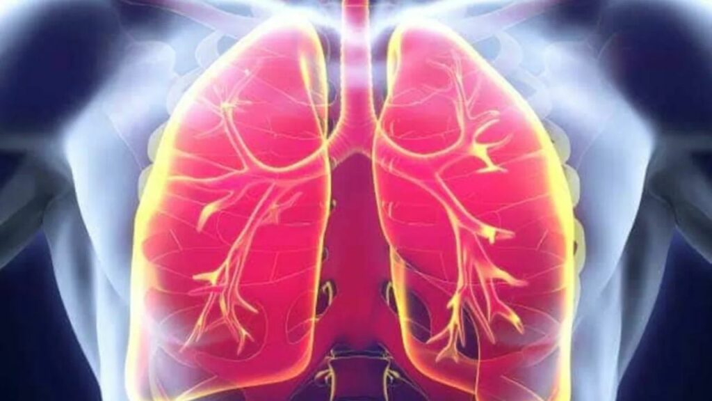 Summer Special: गर्मियों में धूल भरी आंधी से फेफड़ों को बचाने के लिए जरूर करें ये 5 काम