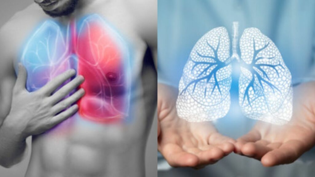 Summer Special: गर्मियों में धूल भरी आंधी से फेफड़ों को बचाने के लिए जरूर करें ये 5 काम