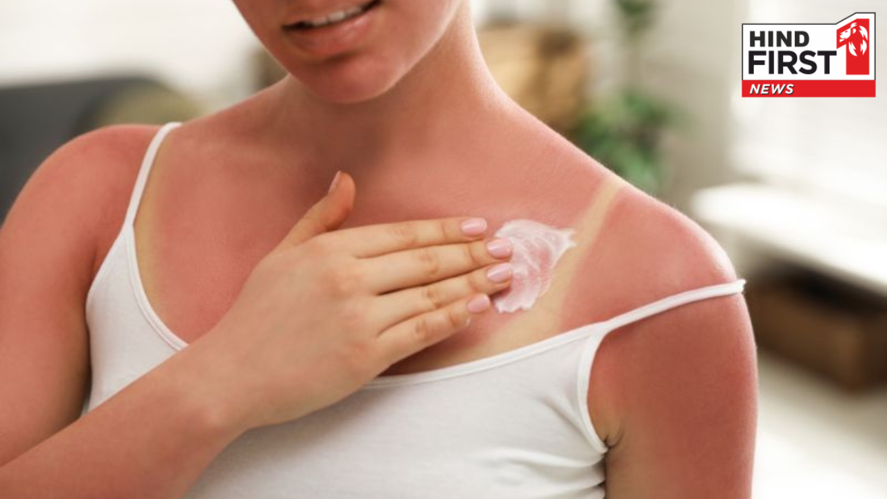 पांच स्किन प्रॉब्लम जो गर्मियों में है आम बात, इन घरेलु उपायों से करें ठीक पांच स्किन प्रॉब्लम जो गर्मियों में है आम बात, इन घरेलु उपायों से करें ठीक