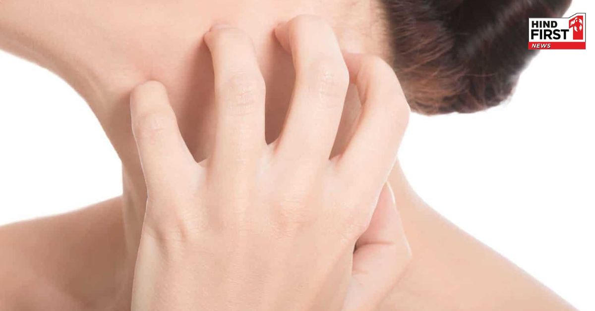 अगर गर्मी के कारण हो गई है स्किन एलर्जी, तो इन तरीकों से पा सकतें हैं छुटकारा