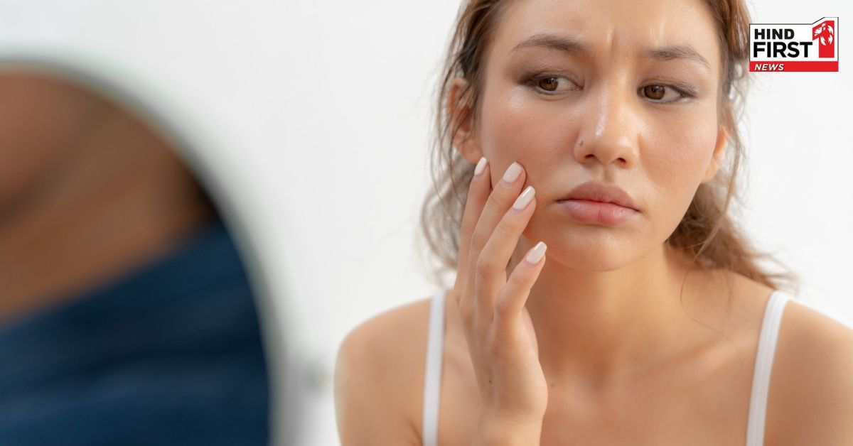 गर्मियों में के मौसम में बिना चिपचिपाहट के इस तरह करें स्किनकेयर