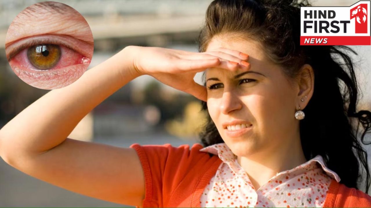 हीट वेव से आंखें हो सकती हैं ख़राब, जानिए कैसे करें बचाव