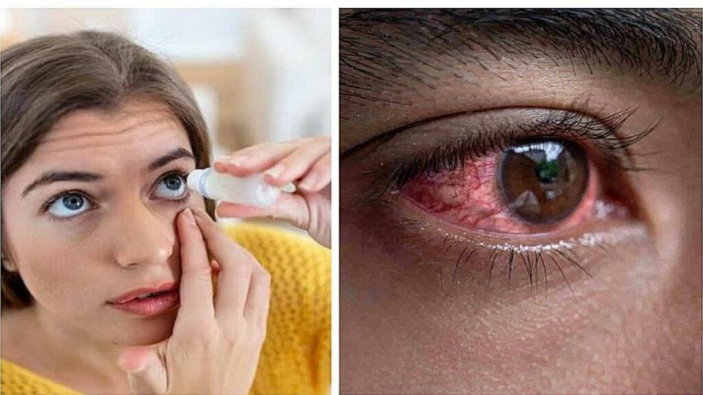   Health Care: बारिश में आई फ्लू होने का है ज्यादा डर, जानिए इसके लक्षण और बचाव के उपाय