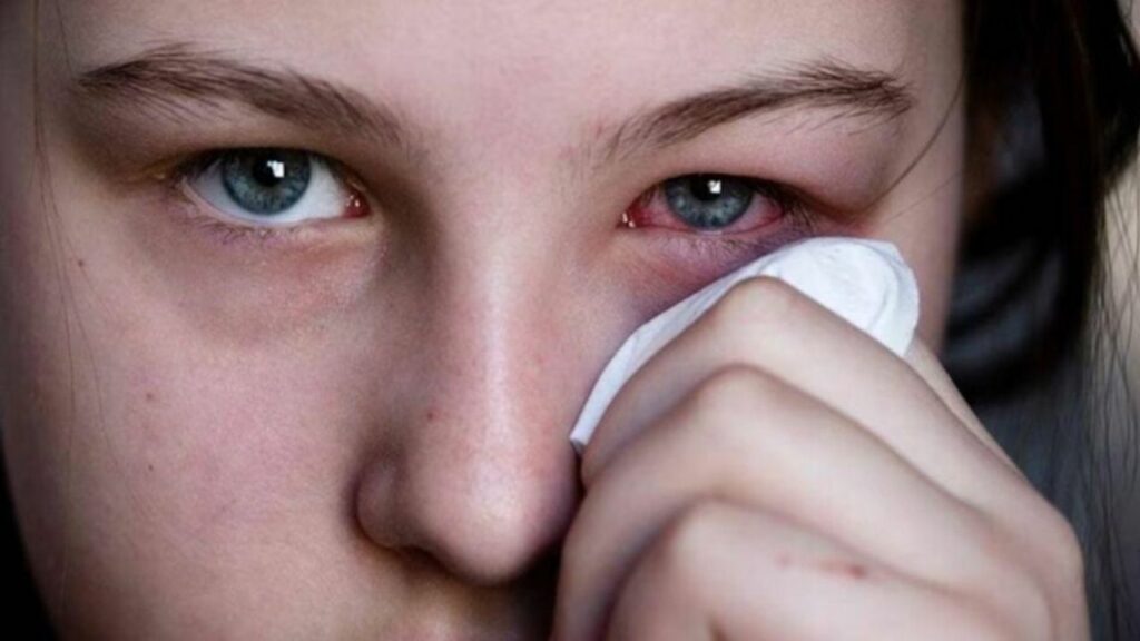   Health Care: बारिश में आई फ्लू होने का है ज्यादा डर, जानिए इसके लक्षण और बचाव के उपाय 