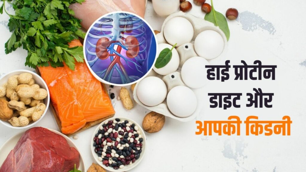 Protein Side Effects: सावधान! ज्यादा प्रोटीन का सेवन किडनी कर सकता है ख़राब
