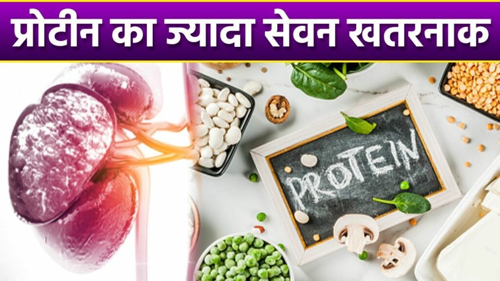 Protein Side Effects: सावधान! ज्यादा प्रोटीन का सेवन किडनी कर सकता है ख़राब