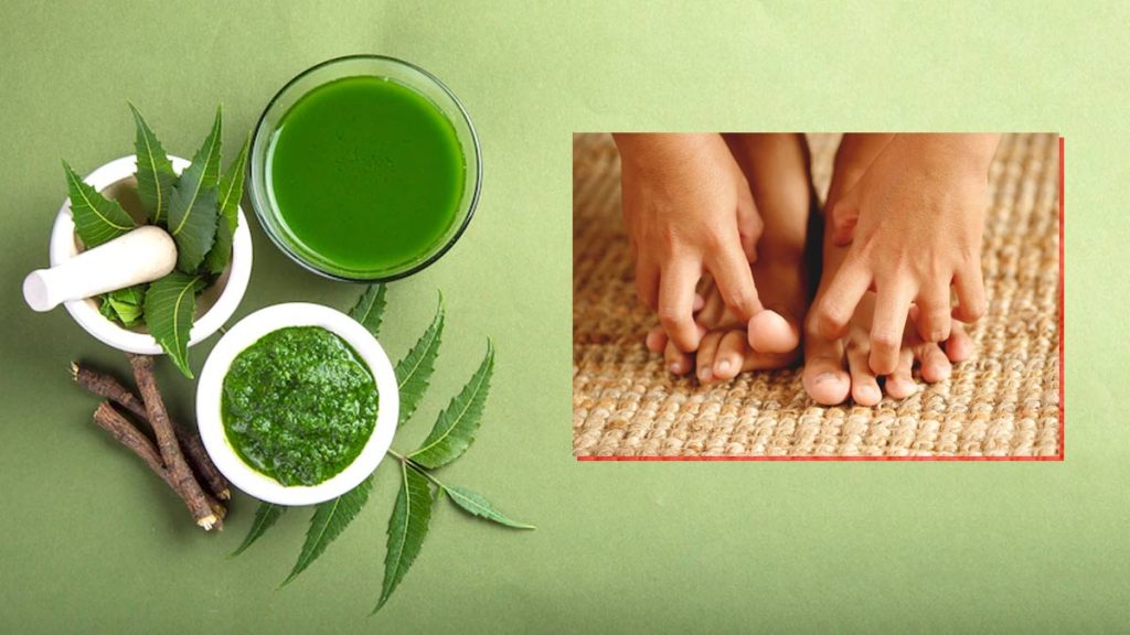 Skincare in Monsoon: आयुर्वेद के सहारे मानसून में रखें अपने स्किन का ख्याल, जानिए कैसे