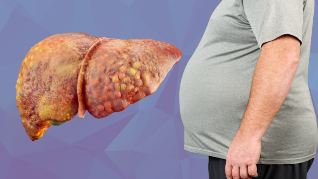 Fatty Liver: फैटी लिवर की समस्या को दूर करने में हेल्पफुल है एप्पल साइडर विनेगर, जानें कैसे