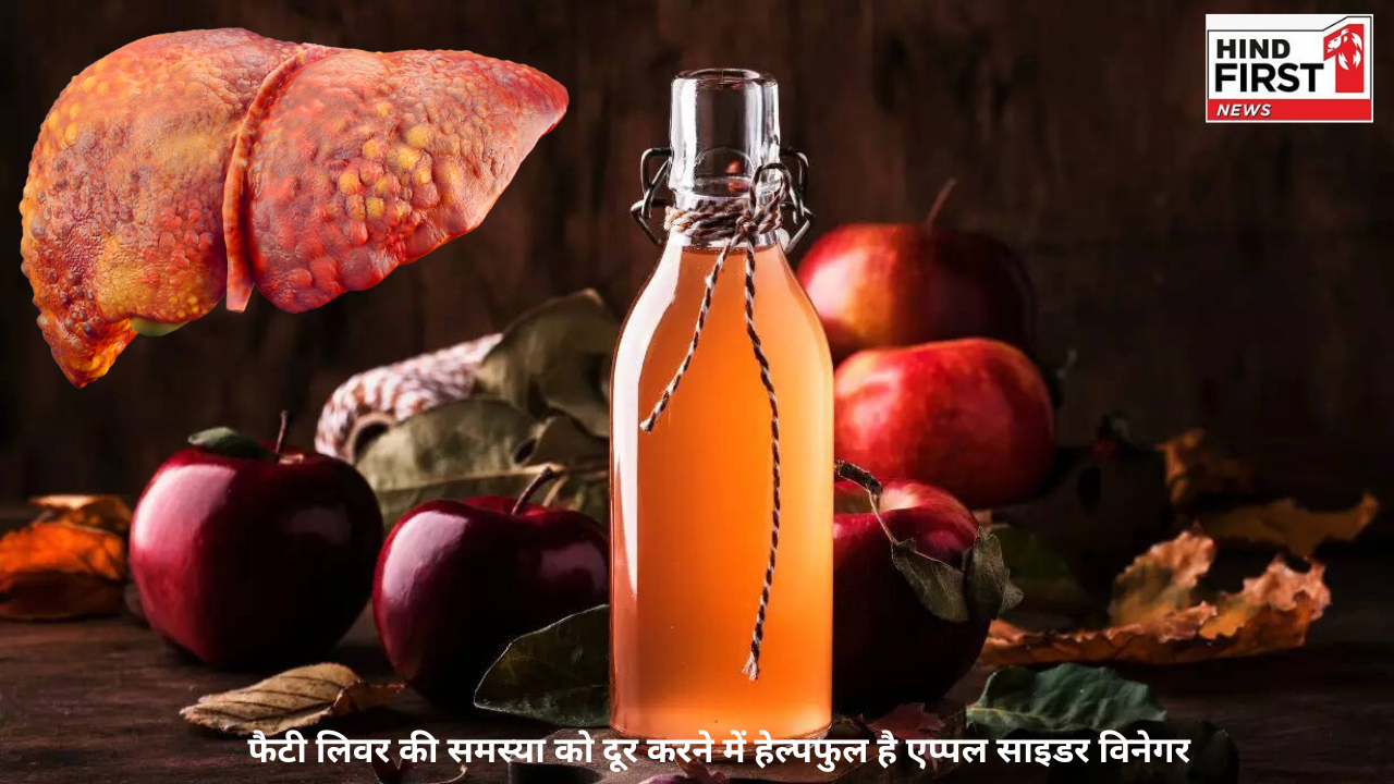 Fatty Liver: फैटी लिवर की समस्या को दूर करने में हेल्पफुल है एप्पल साइडर विनेगर, जानें कैसे Fatty Liver: फैटी लिवर की समस्या को दूर करने में हेल्पफुल है एप्पल साइडर विनेगर, जानें कैसे