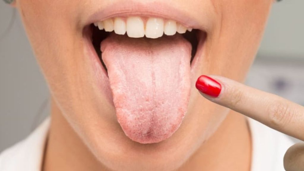 Health Tips: आपकी जीभ बताती है आपके सेहत के हालात, ऐसे पहचानें परेशानी