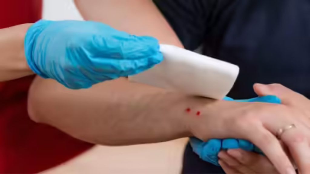 Health Care: सांप काटने के तुरंत बाद करना चाहिए ये फर्स्टऐड, बच सकती है जान 