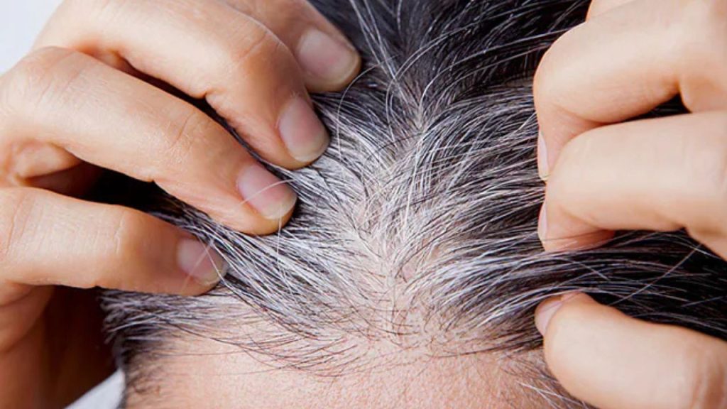   Hair Care: सावधान! गंदा हेलमेट पहनने से आपके बालों हो सकते हैं बहुत बीमार, ऐसे करें देखभाल 