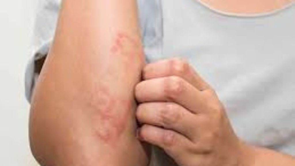 Chia Seed Side Effects: ओह ! रोजाना चिया सीड का खाना आपको कर सकता है बहुत बीमार