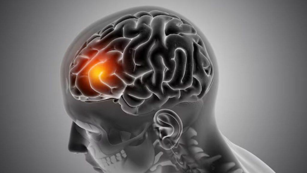   Mental Stress: लगातार रील देखना कर सकता है आपको दिमागी रूप से बहुत बीमार, संभल जाएं 