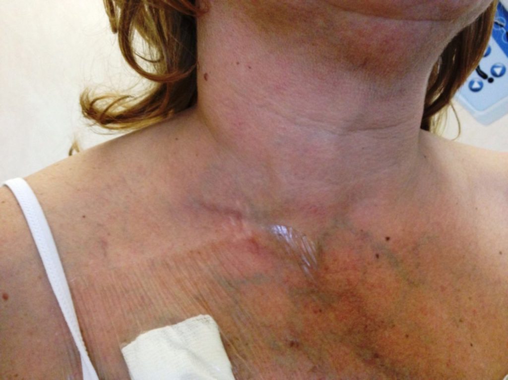 Kidney Disease: चेहरे और गर्दन पर नजर आते हैं किडनी रोग के लक्षण, आप भी जानें  