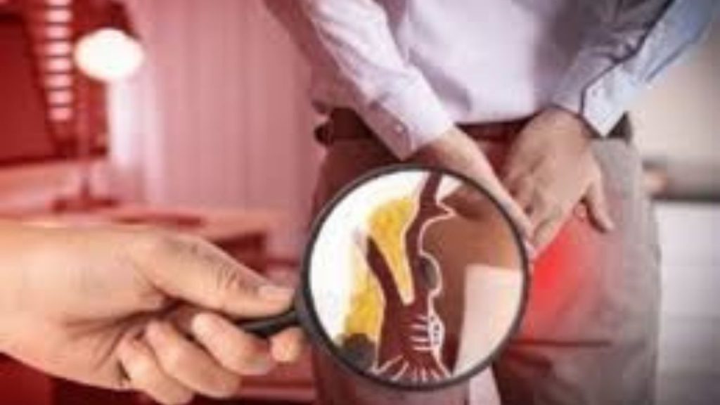 Health Tips: पाइल्स के मरीज़ों को इन 5 चीजों से बना लेनी चाहिए दूरी 