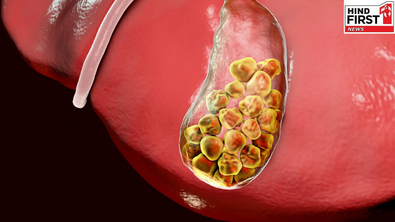 Gallbladder Stones: रोज़मर्रा की 5 आदतें जो बढाती हैं गॉल ब्लैडर की पथरी का ख़तरा