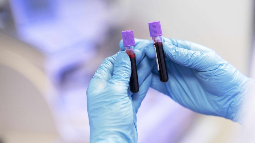 Ferritin Test: क्या होता है फेरिटिन टेस्ट, क्यों महिलाओं के लिए है ये जरुरी? जानिए सबकुछ