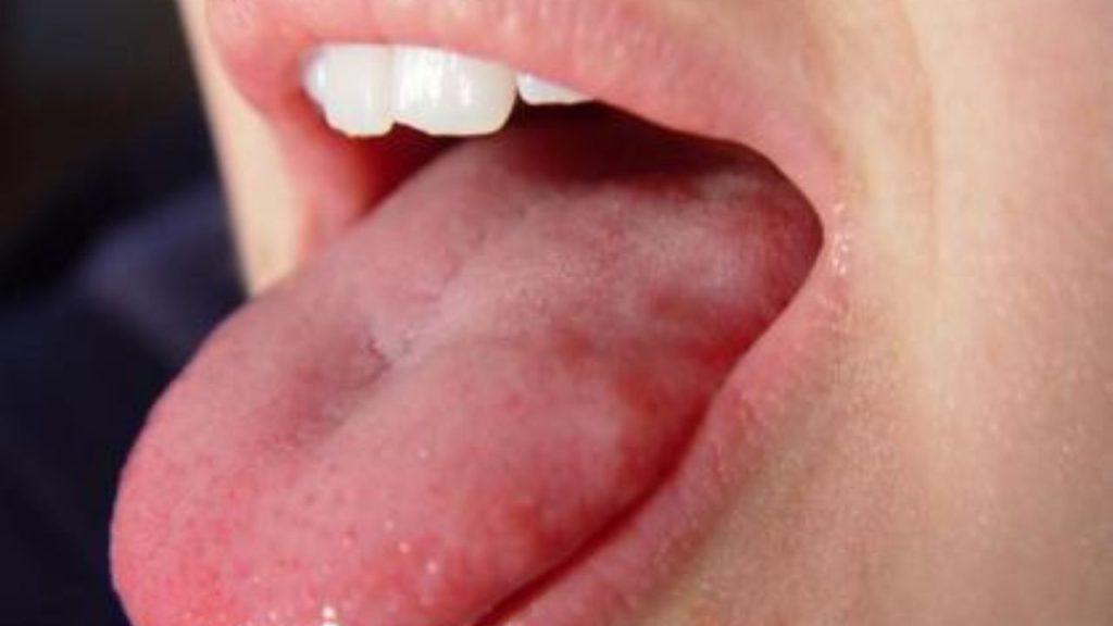 Health Alert : आपकी ख़राब ओरल हेल्थ कैंसर का बन सकता है कारण, हो जाएं अलर्ट 