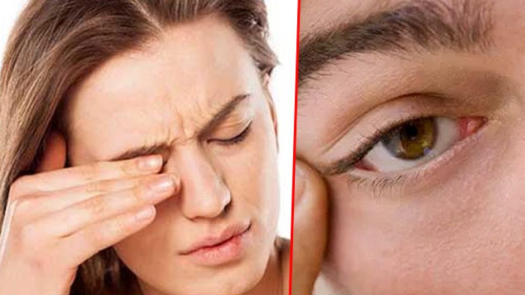  Health Update: अपशगुन नहीं बल्कि शरीर में इन चीजों की कमी से फड़कती हैं आंखें , आप भी जान लीजिए 