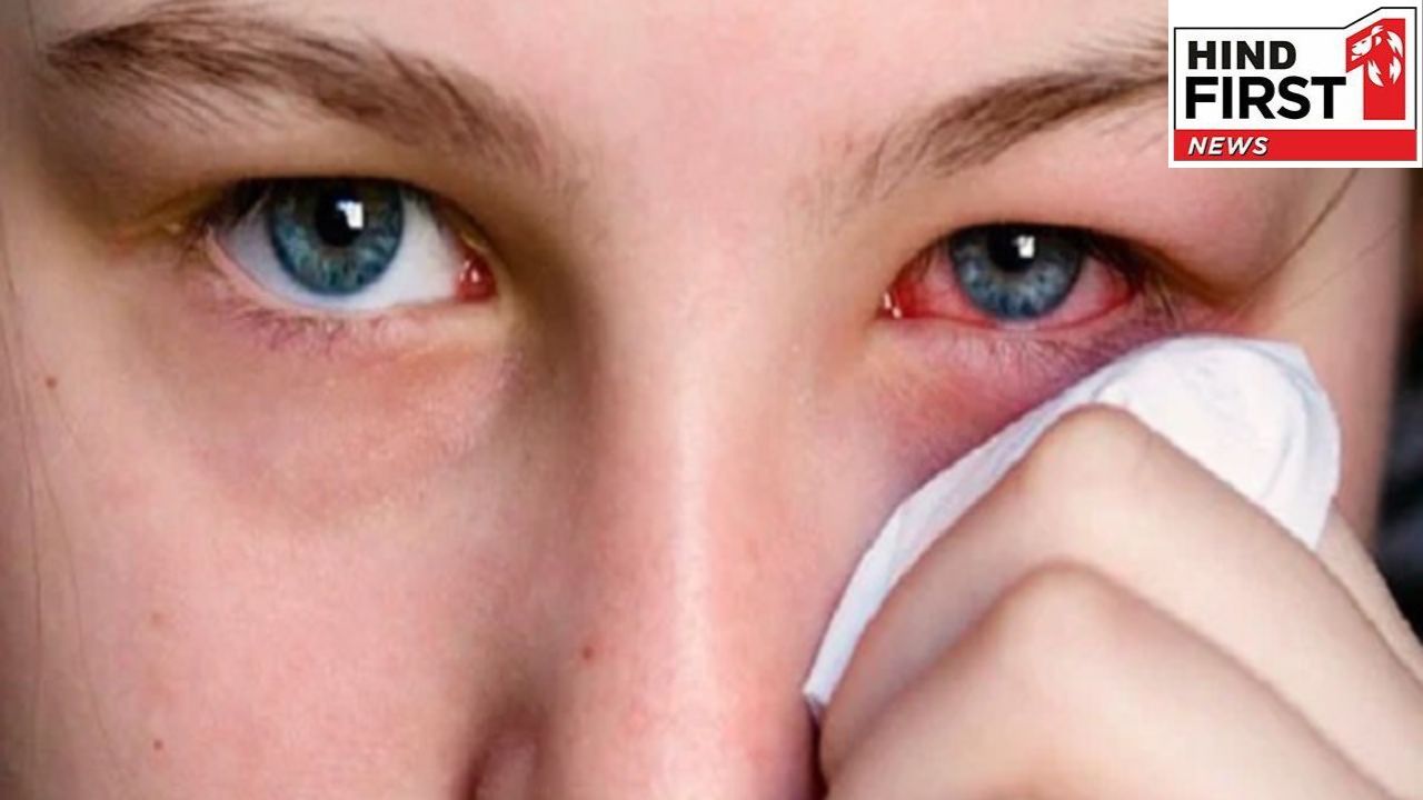 Conjunctivitis: कंजक्टिवाइटिस के इन शुरूआती लक्षणों को ना करें इग्नोर, वरना हो सकती है बड़ी परेशानी