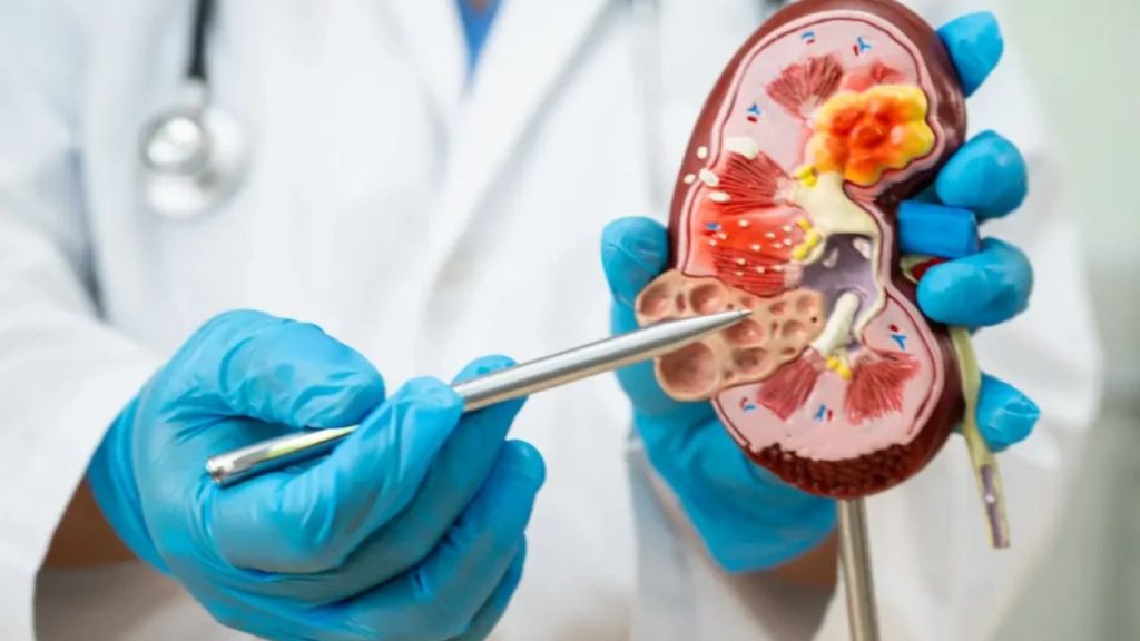 Satish Shah Death: किडनी ट्रांसप्लांट या डायलिसिस, जानें क्या है बेहतर   