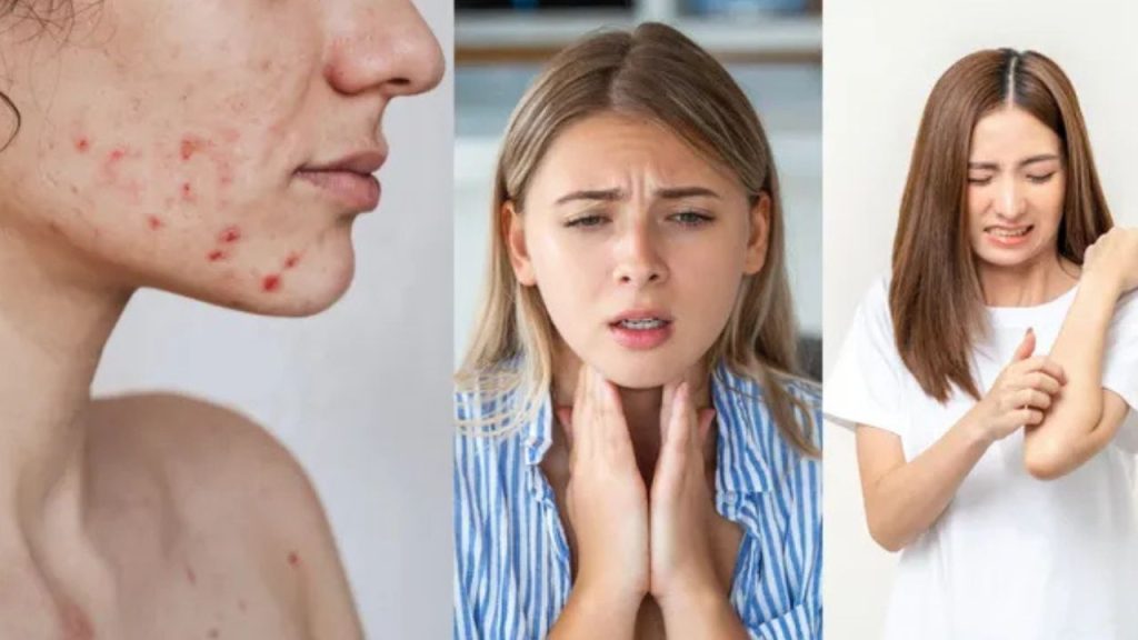   Health Ki Baten: इन लोगों को नहीं खाना चाहिए दही वरना बढ़ जाएगी मुसीबत 