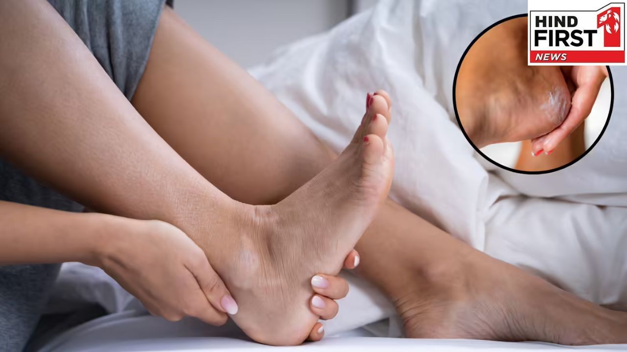 Winter Care Tips: सर्दियों में फटी एड़ियों से ना हो शर्मिंदा, इन घरेलू तरीकों से करें ठीक