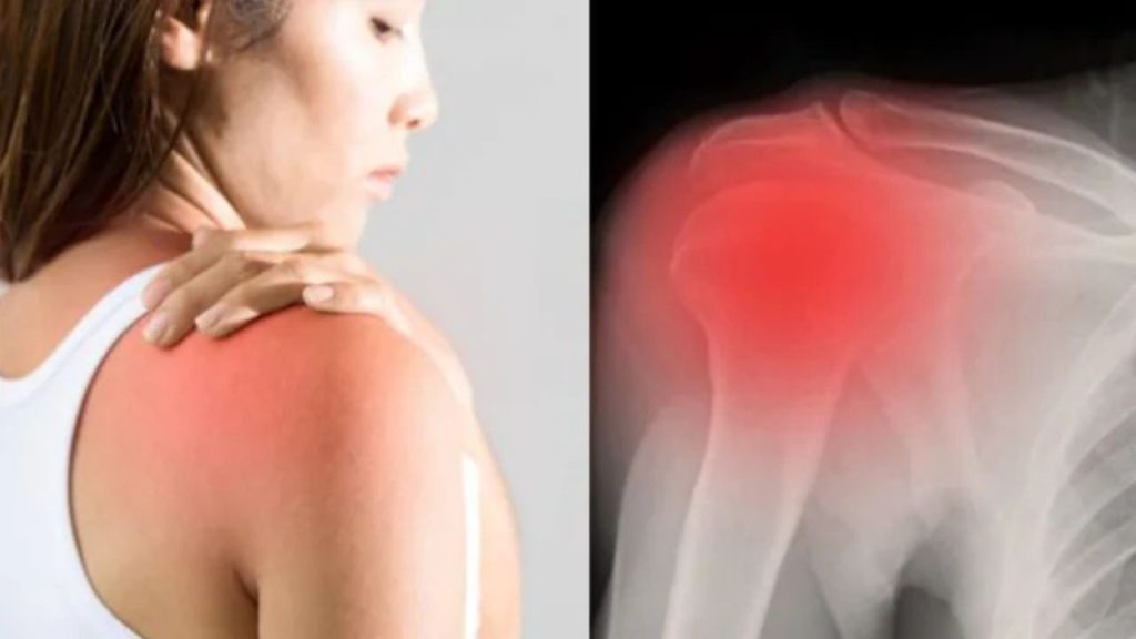  Frozen Shoulder: सर्दियों में क्यों बढ़ जाती है फ्रोजेन शोल्डर की समस्या, महिलाएं होती हैं ज्यादा शिकार 